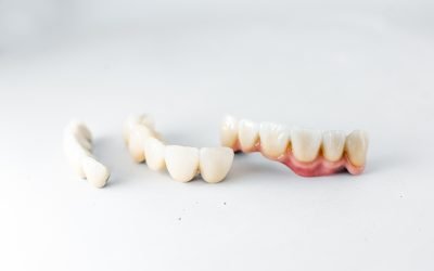 Same-Day Crowns: The Future of Dental Restoration