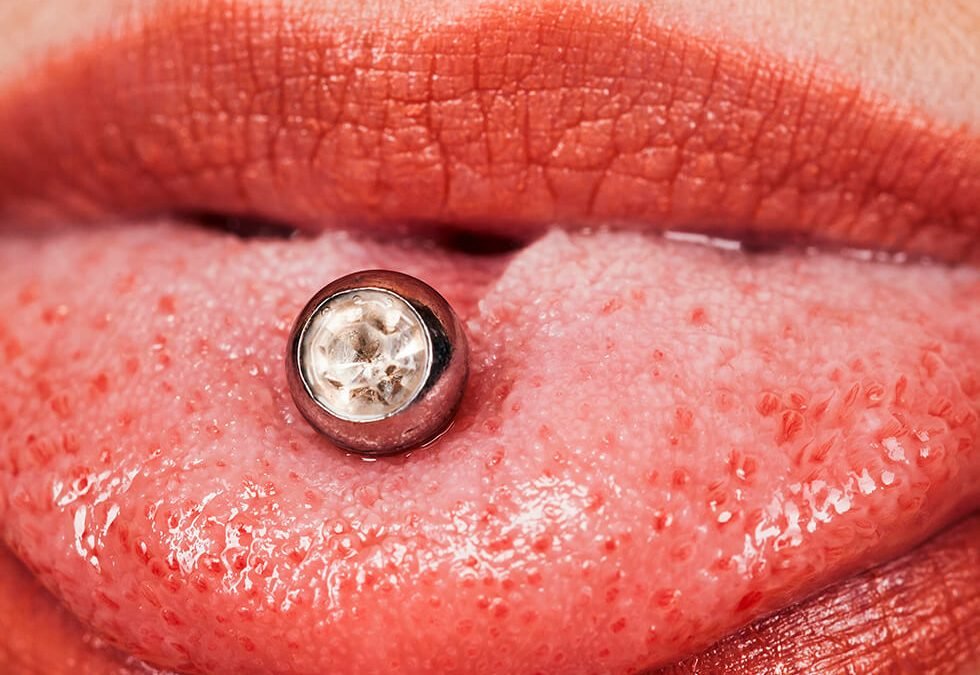 Unlocking the Allure of Oral Piercings: Navigating a Daring Fashion Statement for Dental Well-being